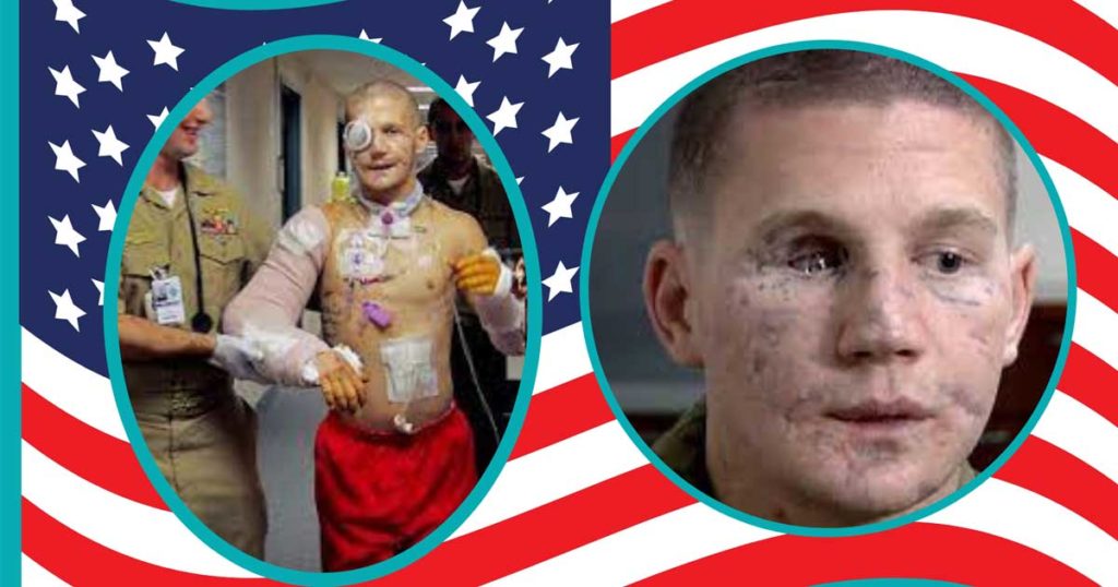 "You are Worth It" Beyond the Medal with Kyle Carpenter I'm Dying to Tell You Podcast